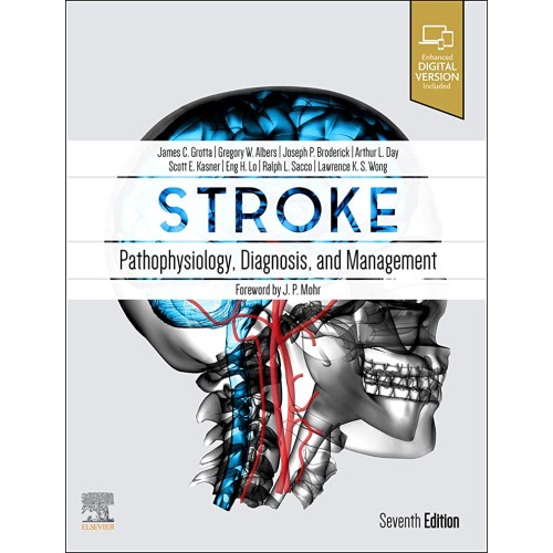 Stroke: Pathophysiology, Diagnosis, and Management -7E