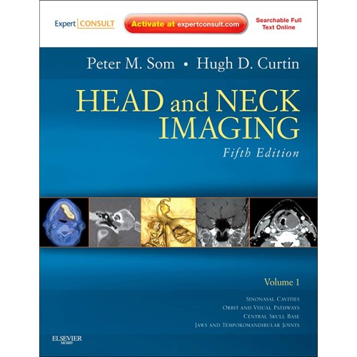 Head and Neck Imaging 5/e (2 Vols)