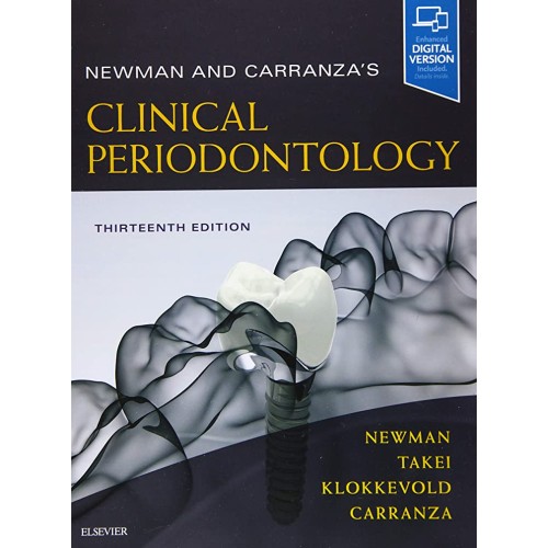 Newman and Carranza's Clinical Periodontology -13E