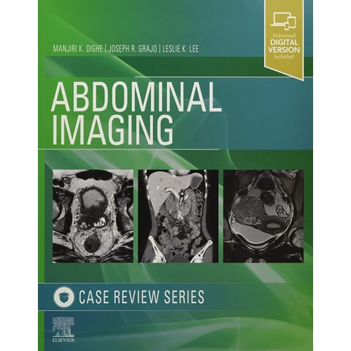 Abdominal Imaging-1ED