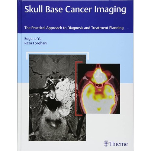 Skull Base Cancer Imaging 1st Edition