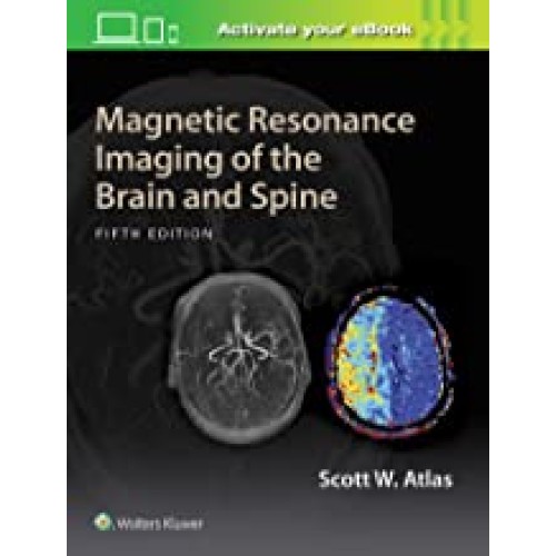 Magnetic Resonance Imaging of the Brain and Spine, None