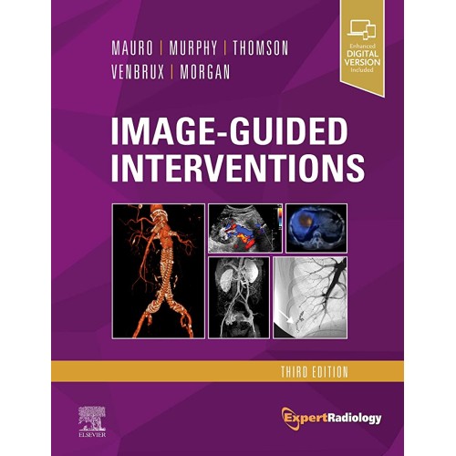 Image-Guided Interventions-3E