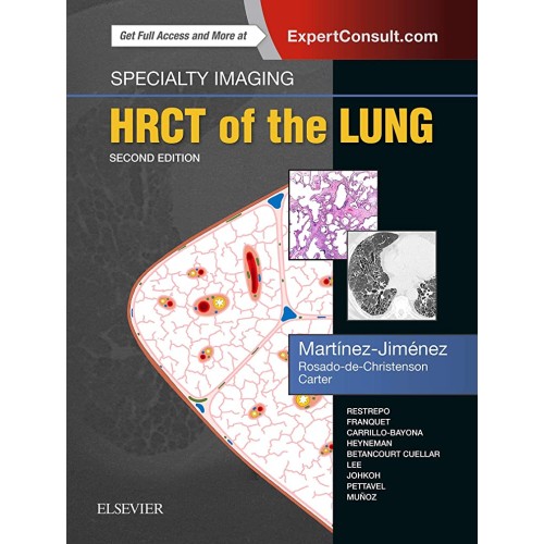 Specialty Imaging: HRCT of the Lung - 2E