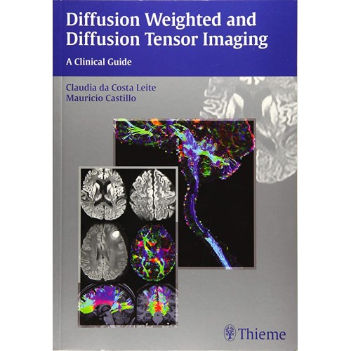 Diffusion Weighted and Diffusion Tensor Imaging A Clinical Guide 1st Edition