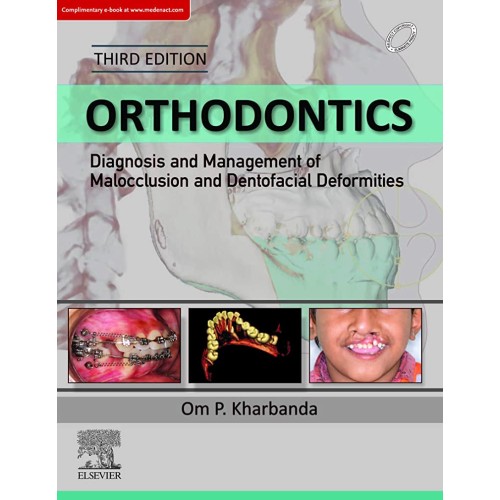 Orthodontics: Diagnosis and Mgmt of Malocclus...