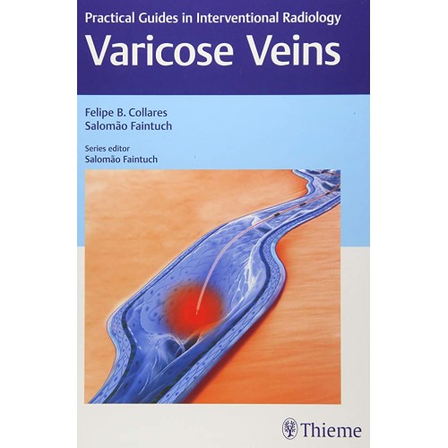 Varicose Veins Practical Guides in Interventional Radiology 1st Edition