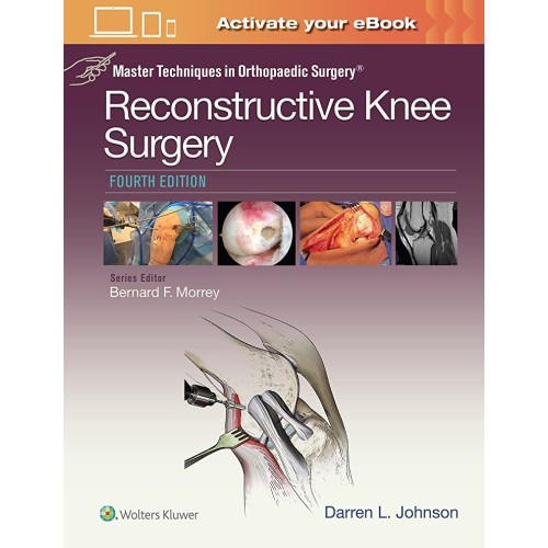 Master Techniques in Orthopaedic Surgery: Reconstructive Knee Surgery - 4 E