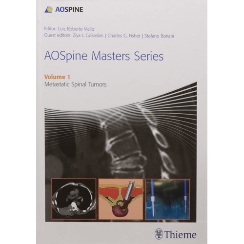 AOSpine Masters V1 Metastatic Spnl Tumors Indnprnt