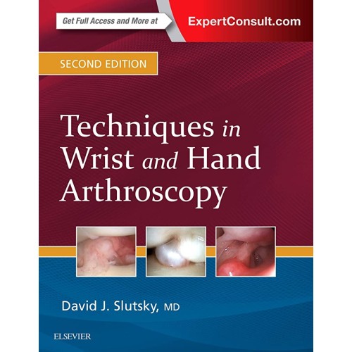 Techniques in Wrist and Hand Arthroscopy -2E