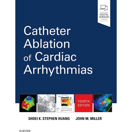 Catheter Ablation of Cardiac Arrhythmias -4E