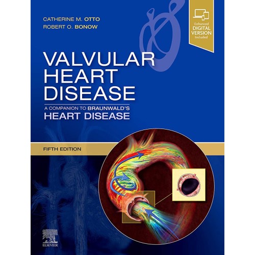 Valvular Heart Disease: A Companion to Braunwald's Heart Disease - 5e