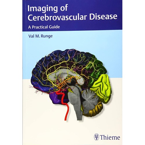 Imaging of Cerebrovascular Disease A Practical Guide 1st Edition