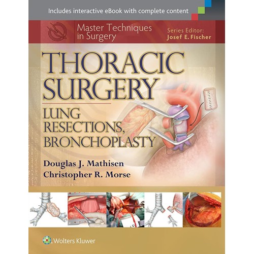 Master Techniques in Surgery: Thoracic Surgery: Lung Resections, Bronchoplasty -2E