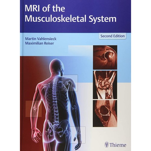 MRI of the Musculoskeletal System 2nd Edition