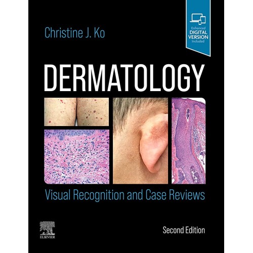 Dermatology: Visual Recognition and Case Reviews-2E