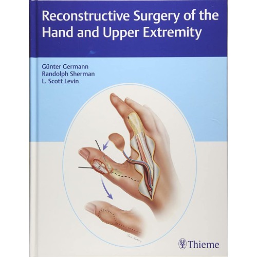 Reconstructive Surgery of the Hand and Upper ...