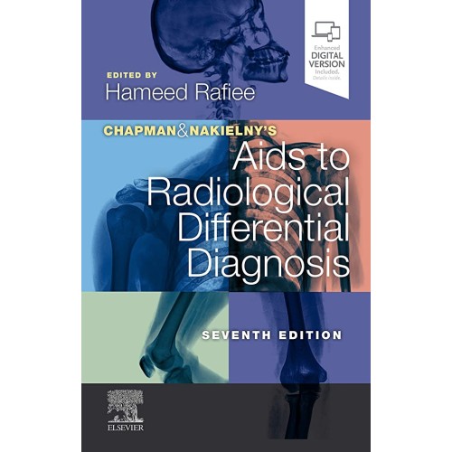 Chapman & Nakielny's Aids to Radiological Differential Diagnosis - 7E