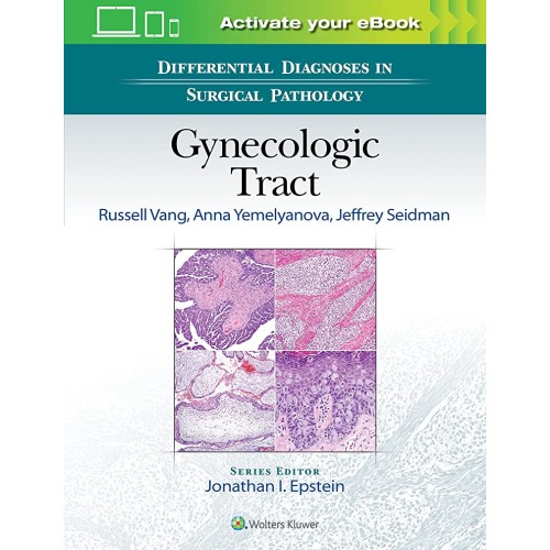 Differential Diagnoses in Surgical Pathology: Gynecologic Tract - 1E