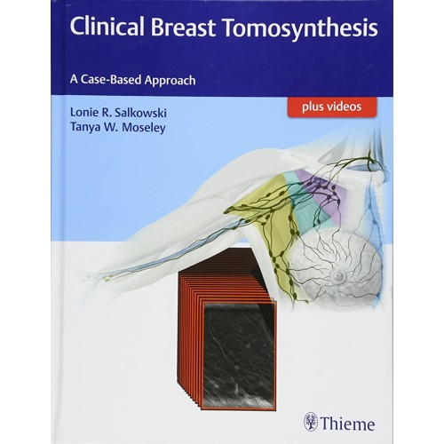 Clinical Breast Tomosynthesis 1st Edition