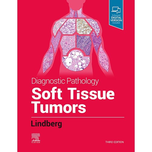 Diagnostic Pathology: Soft Tissue Tumors - 3E