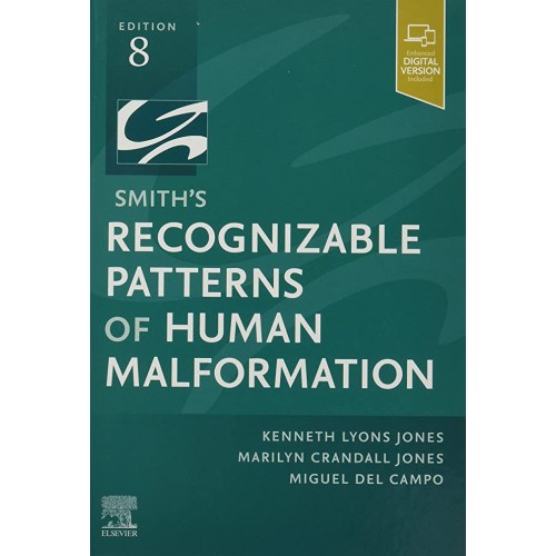 Smith's Recognizable Patterns of Human Malformation - 8E