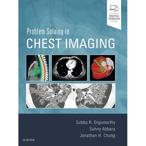 Problem Solving in Chest Imaging -1E