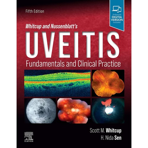 Whitcup and Nussenblatt's Uveitis-5E