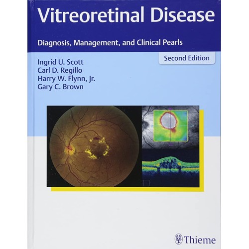 Vitreoretinal Disease 2nd Edition