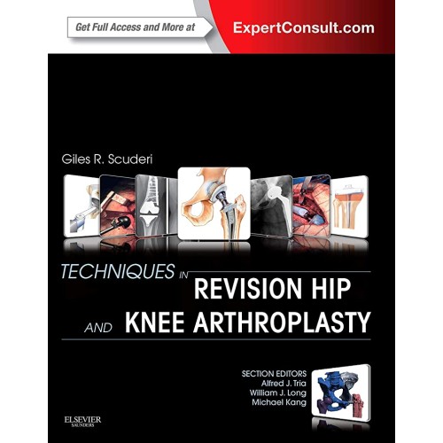 Techniques in Revision Hip& Knee Arthroplasty-1E