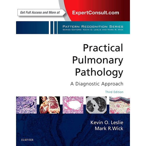 Practical Pulmonary Pathology: A Diagnostic Approach: A Volume in the Pattern Recognition Series