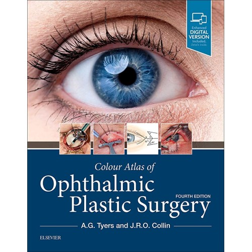 Colour Atlas of Ophthalmic Plastic Surgery -4E