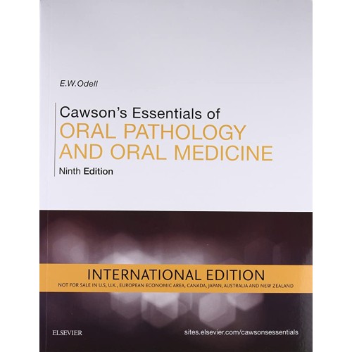 Cawson's Essentials of Oral Pathology and Oral Medicine, IE - 9E