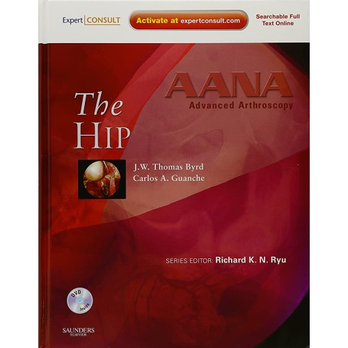 Advanced Arthoscopy: The Hip