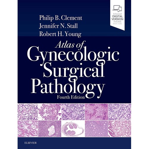 Atlas of Gynecologic Surgical Pathology -4E