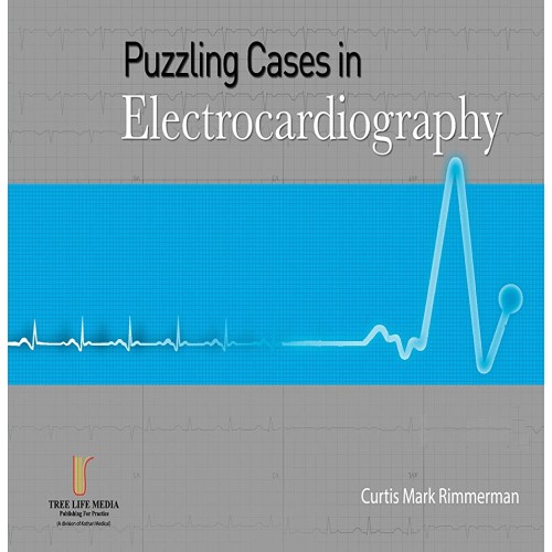 Puzzling Cases in Electrocardiography