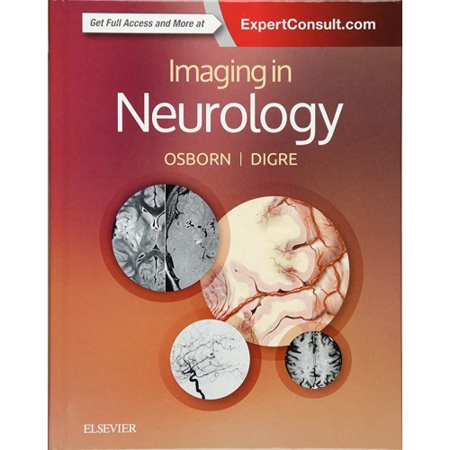 Imaging in Neurology