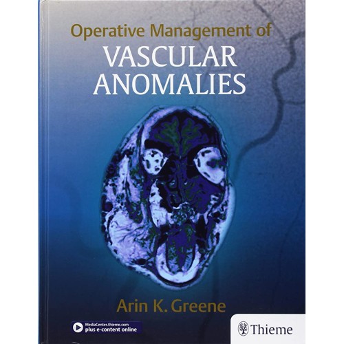 Operative Management of Vascular Anomalies 1st Edition