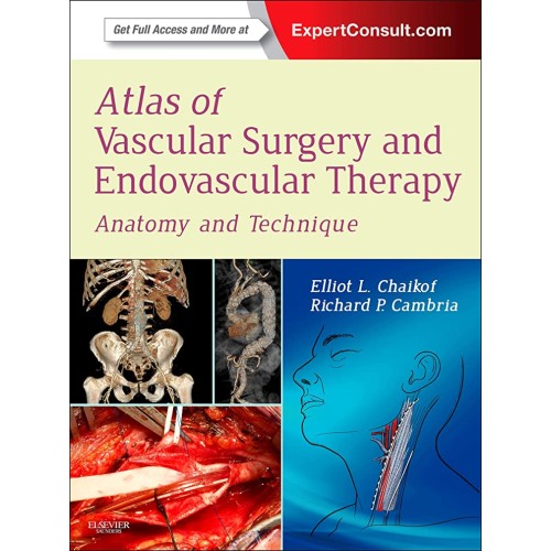 Atlas of Vascular Surgery & Endovascular Therapy - 1E