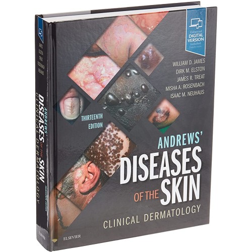 Andrews' Diseases of the Skin-13E