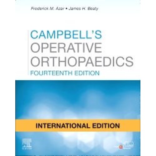 Campbell's Operative Orthopaedics IE - (4-Vol Set) - 14E