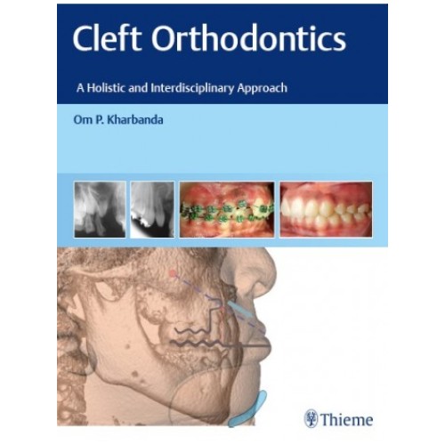 Cleft Orthodontics 1st Edition